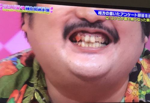鈴木もぐらは歯がないからかわいい！？歯の本数もまとめて調査！