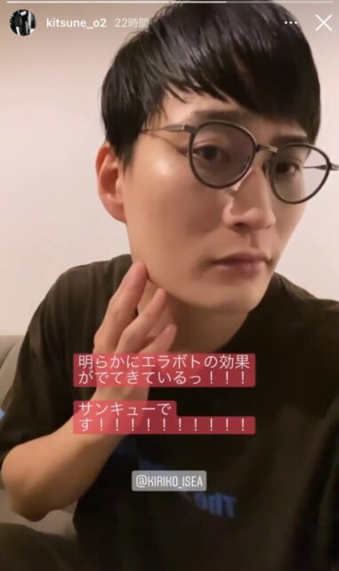 【きつね】大津広次さんはイケメンで美容に詳しい！？愛用眼鏡は？